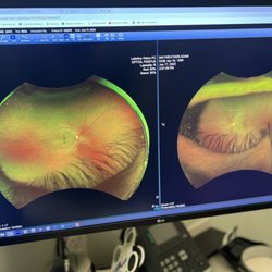 Lakeline Vision Source