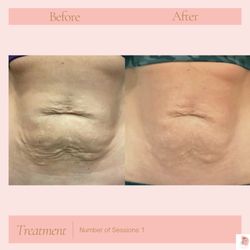 SkinSational Medspa - Physiq 360