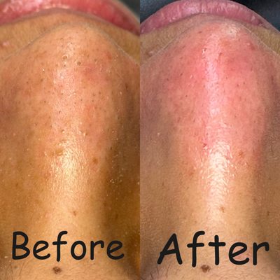 Skin Care - Choose to prioritize your well-being with a service that elevates both your skin's texture and your
relaxation levels.