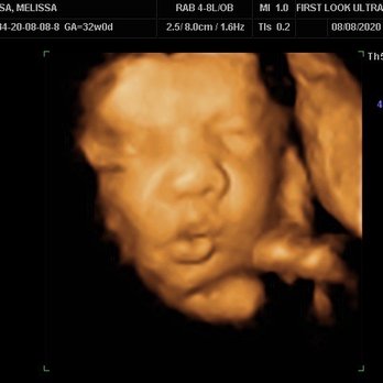 First Look Ultrasound - Diagnostic Imaging Near Me - Kaneohe, Hawaii