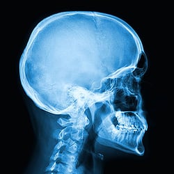 RWJ Rehabilitation at Delaware Valley - CERTIFIED CERVICAL & TEMPOROMANDIBULAR THERAPISTS