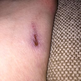 Pedicure aftermath.