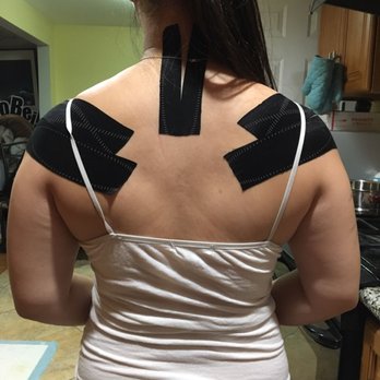 AcuNurture Acupuncture & Herbs - Kt tape for my neck and shoulder pain - Acupuncture Near Me - Duarte, California AcuNurture Acupuncture & Herbs - Kt tape for my neck and shoulder pain - Acupuncture Near Me - Duarte, California