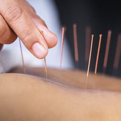 Chah AcuTherapy