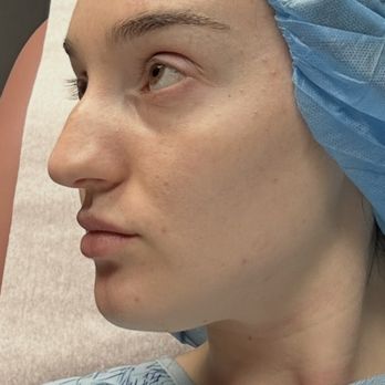 Jacob Sedgh, MD - Cosmetic Surgeons Near Me - West Hollywood, California