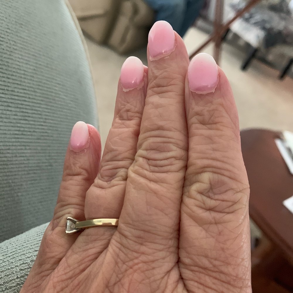 Poor quality manicure with cut cuticles Poor quality manicure with cut cuticles