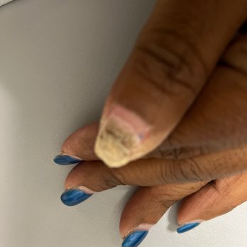 Grand Nails Salon - Update: Going to remove all the gel. I'm guessing all of them are infected. This is awful - Nail Salons Near Me - Jacksonville, North Carolina Grand Nails Salon - Update: Going to remove all the gel. I'm guessing all of them are infected. This is awful - Nail Salons Near Me - Jacksonville, North Carolina