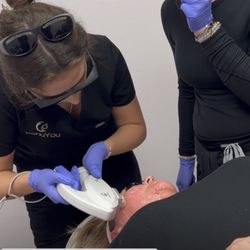 IPL photo facial