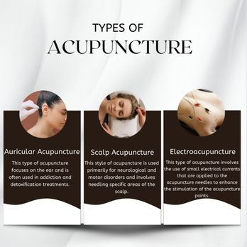 Simply Divine Health spa - Acupuncture Near Me - Cedar Rapids, Iowa Simply Divine Health spa - Acupuncture Near Me - Cedar Rapids, Iowa