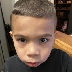 Highlands Elementary School - Does this in-door picture look like my son has bacterial or viral conjunctivitis?