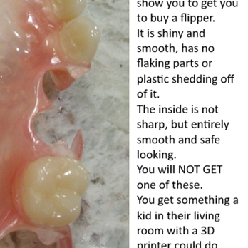 Haslam Dental - What they show you to get you to buy one. - General Dentistry Near Me - Ogden, Utah