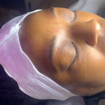 Indycas Illuminating Aesthetics - Skin Care Near Me Indycas Illuminating Aesthetics - Skin Care Near Me