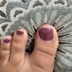 Sunray Nails & Spa - The polish on my skin is just the cherry on top. It was all over my hands too.