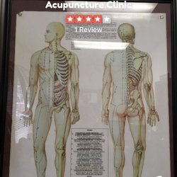 Ticzon Acupuncture Clinic