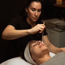 Medical grade skin peels available.