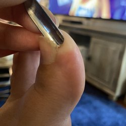 Nail Tech - I asked for a straight cut because I am prone to ingrown nails - and what do I have now... two ingrown big toe nails.