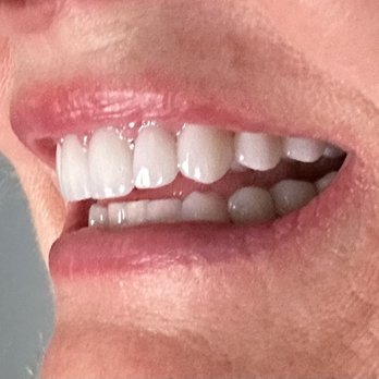 Jamie Elizabeth Sands, DDS - Cosmetic Dentists Near Me - Studio City, California Jamie Elizabeth Sands, DDS - Cosmetic Dentists Near Me - Studio City, California
