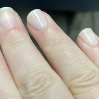 The Best Nails Chicago - Nails peeled off. - Nail Technicians Near Me - Chicago, Illinois The Best Nails Chicago - Nails peeled off. - Nail Technicians Near Me - Chicago, Illinois
