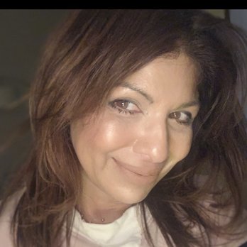 Eyesthetica - Pasadena Eyelid Surgery - Eyes are all healed up!  Thank you Dr. Burnstine! - Cosmetic Surgeons Near Me - Pasadena, California