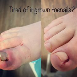 Skagit Foot and Ankle Clinic