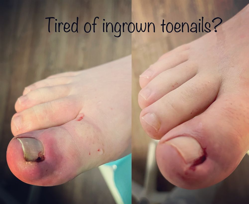 SKAGIT FOOT AND ANKLE CLINIC Updated October 2024 1617 E Division