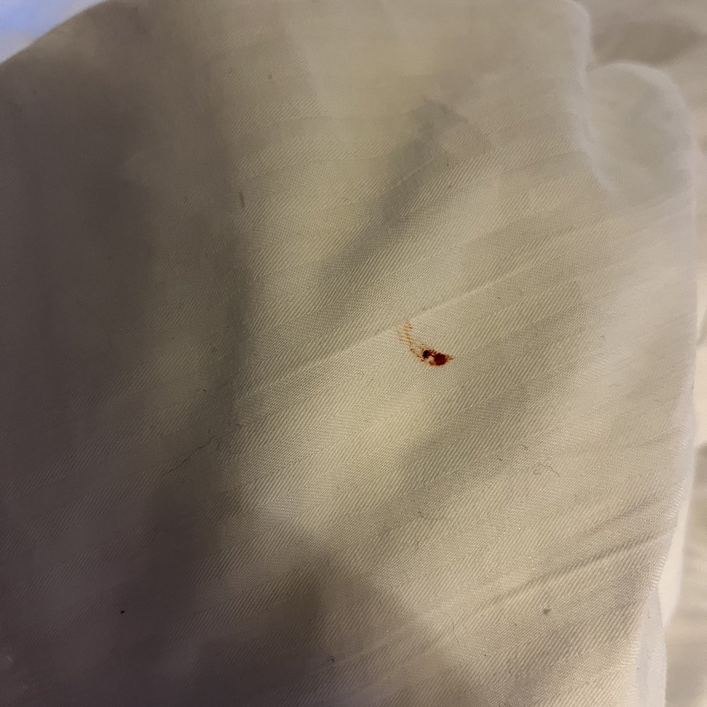 Hilton Concord - After smashing the bed bug, you see evidence of a recent blood meal (bright red blood). - Hotels Near Me - Concord, California Hilton Concord - After smashing the bed bug, you see evidence of a recent blood meal (bright red blood). - Hotels Near Me - Concord, California