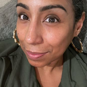 Hello Skin - A few days after lift. - Skin Care Near Me - Ontario, California Hello Skin - A few days after lift. - Skin Care Near Me - Ontario, California