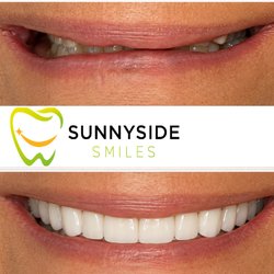 Sunnyside Smiles - Smiles Make Over