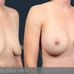 Daniel G Kolder, MD - Pacifica Center for Plastic Surgery