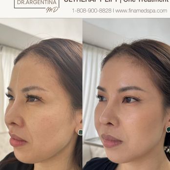 Fina MedSpa - Skin Care Near Me - Honolulu, Hawaii Fina MedSpa - Skin Care Near Me - Honolulu, Hawaii