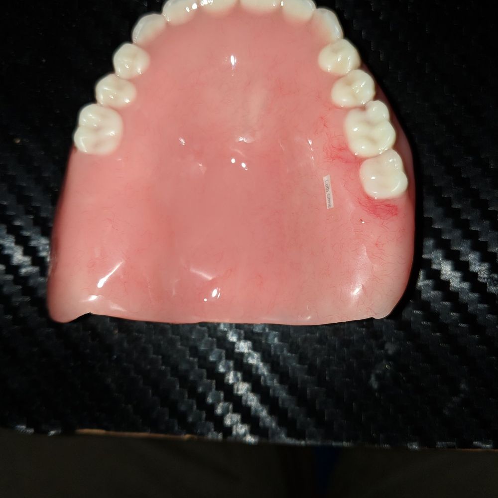 Aspen Dental - Mattoon, IL - Missing teeth in this denture plate due to negligence and  malpractice - Oral Surgeons Near Me - Mattoon, Illinois