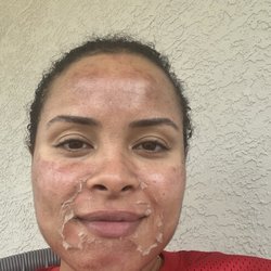 Addicted to Skin the Beauty & Aesthetics Studio - Chemical peel