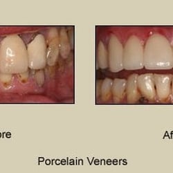 Ashish J Vashi, DDS
