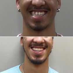 Smile Esthetics