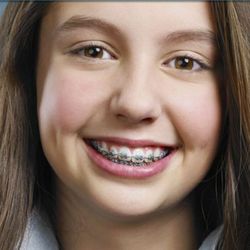 Senestraro Family Orthodontics - Woodstock