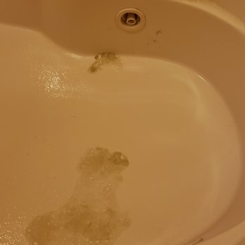 Breezy Point Resort - The dark stuff is what came out of the jets after I cleaned it. - Resorts Near Me - Breezy Point, Minnesota Breezy Point Resort - The dark stuff is what came out of the jets after I cleaned it. - Resorts Near Me - Breezy Point, Minnesota