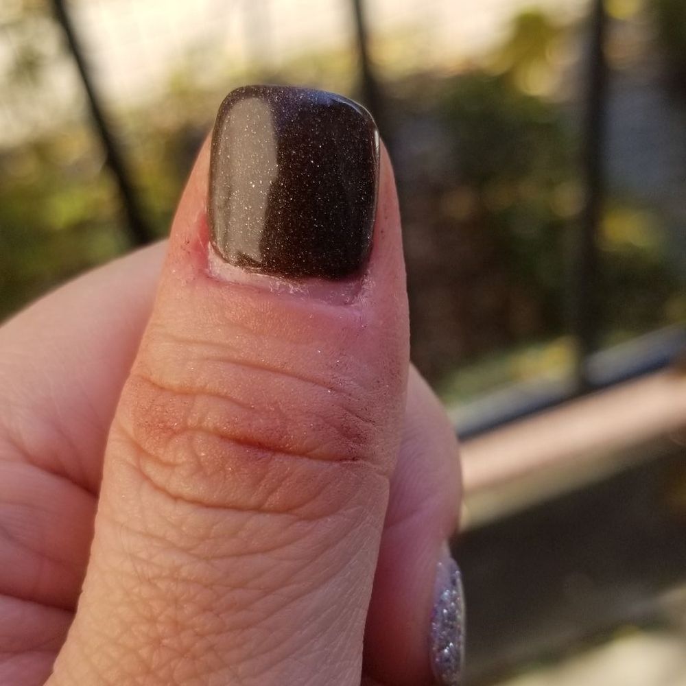 Nail Art Studio - After I pushed back my cuticles, I have this much gap and it has been only 3 days. It looks like I have a 2 weeks worth of nail growth. - Nail Salons Near Me - Northbrook, Illinois Nail Art Studio - After I pushed back my cuticles, I have this much gap and it has been only 3 days. It looks like I have a 2 weeks worth of nail growth. - Nail Salons Near Me - Northbrook, Illinois