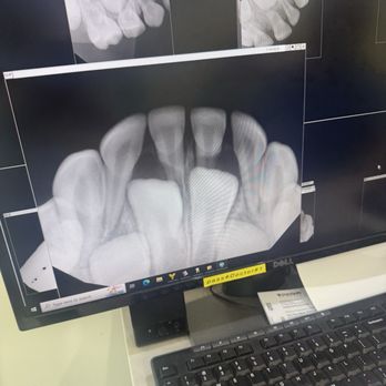 We C Kids Dental - Big boy teeth coming in! - Pediatric Dentists Near Me - El Monte, California We C Kids Dental - Big boy teeth coming in! - Pediatric Dentists Near Me - El Monte, California