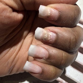 Unique Nail And Spa - The fungus they gave me - Nail Salons Near Me - Humble, Texas
