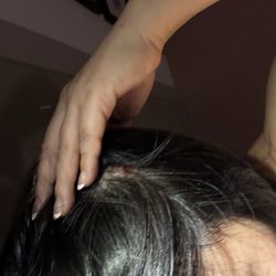 Lewis Wharf Parking - The bar came down and hit my head! I was bleeding! I have a bump on my head!