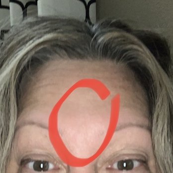 Beverly Hills Plastic Surgery Group - It didn't work immediately, but after a few minutes, I decided to check again and was delighted! - Cosmetic Surgeons Near Me - Beverly Hills, California