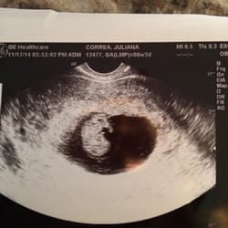 Marc Rosenthal, MD - My little Frijolito picture!