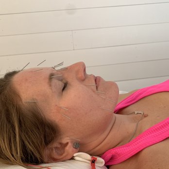Acupuncture + Restorative Medicine - Acupuncture Near Me - Austin, Texas
