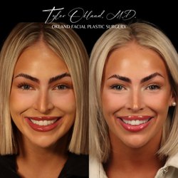 Okland Facial Plastic Surgery