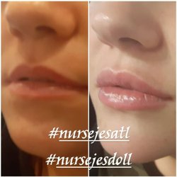 Advanced Aesthetics Artistry - @advancedaestheticsartistry
#nursejesatl
4784448651