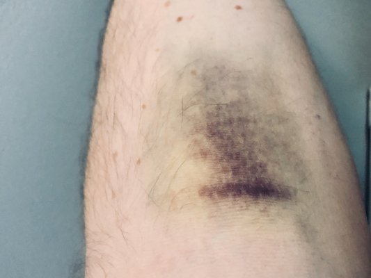 LABCORP - Updated February 2026 - 12 Photos & 20 Reviews - 1-55 Wanaque ...