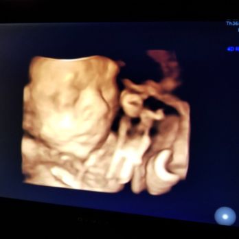 SonoSmile - Diagnostic Imaging Near Me - Ocala, Florida