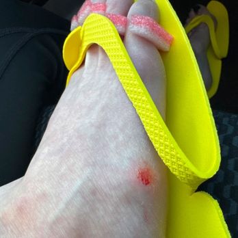 Wynn Nails & Spa - Friends cut foot - Nail Salons Near Me - Del City, Oklahoma Wynn Nails & Spa - Friends cut foot - Nail Salons Near Me - Del City, Oklahoma