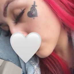 Dermal