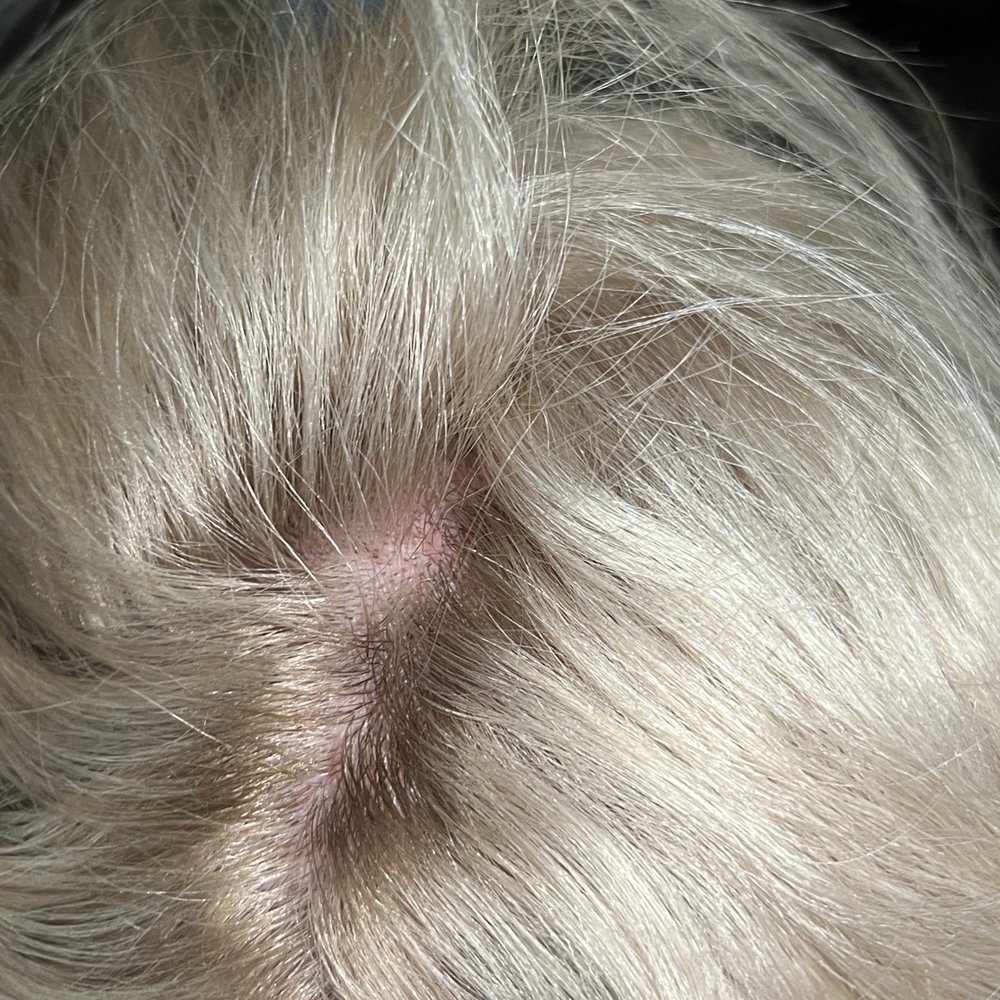 A Blonder Place - Damaged scalp and Blotched shadow root. - Hair Salons Near Me - Highland, California